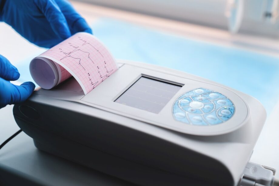 Drukarki niefiskalne są używane w medycynie do drukowania wyników EKG.